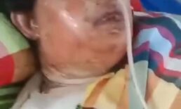 চৌদ্দগ্রামে স্বামীর দেওয়া আগুনে দ্বগ্ধ হয়ে চিকিৎসাধিন অবস্থায় গৃহবধূর মৃত্যু