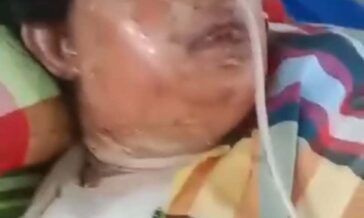 চৌদ্দগ্রামে স্বামীর দেওয়া আগুনে দ্বগ্ধ হয়ে চিকিৎসাধিন অবস্থায় গৃহবধূর মৃত্যু