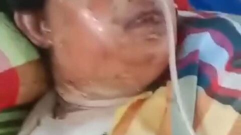 চৌদ্দগ্রামে স্বামীর দেওয়া আগুনে দ্বগ্ধ হয়ে চিকিৎসাধিন অবস্থায় গৃহবধূর মৃত্যু